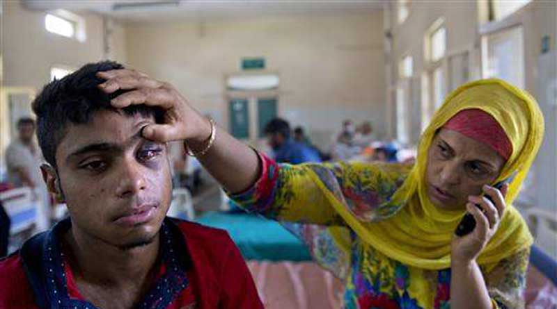   CRPF DG Feels Sorry for the Pellet Gun Injured persons