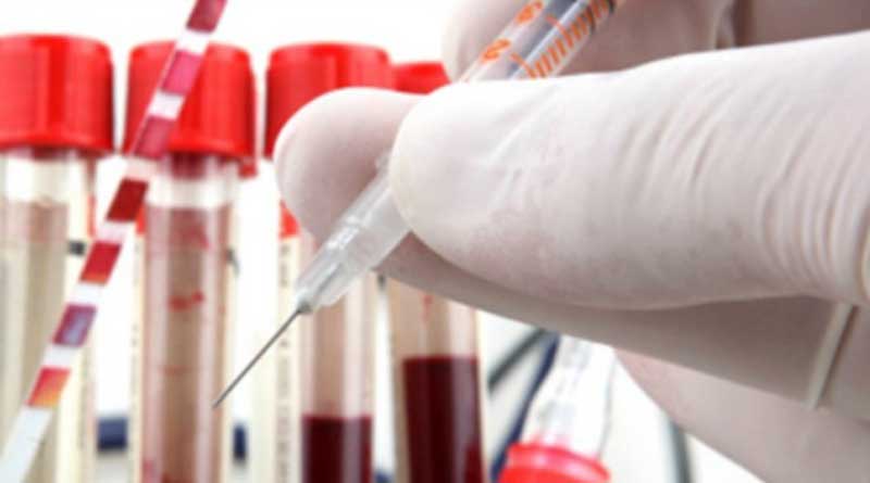 home-test-for-malaria-cancer