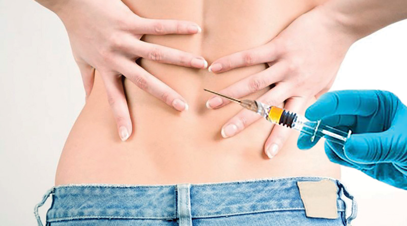 Steroid: Pros And Cons
