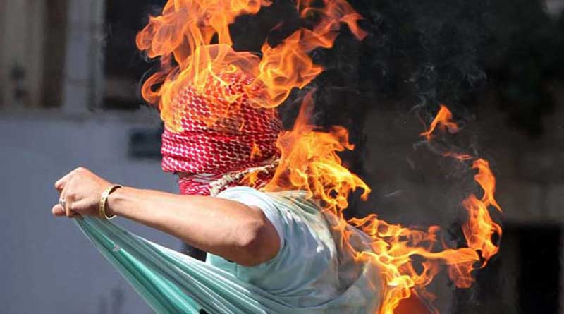 UP boy fights off molesters, they set him on fire