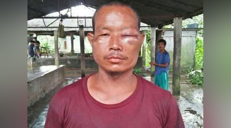 Meghalaya: MLA assaults man for asking ‘uncomfortable’ questions