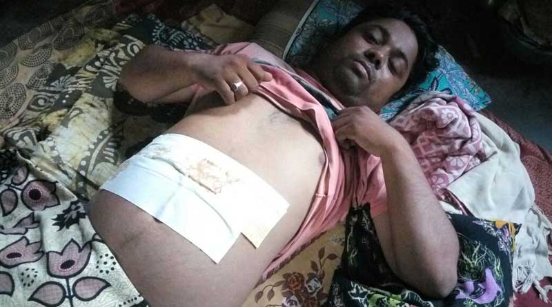 Bankura: Goons attack Durga Puja function, 2 injured