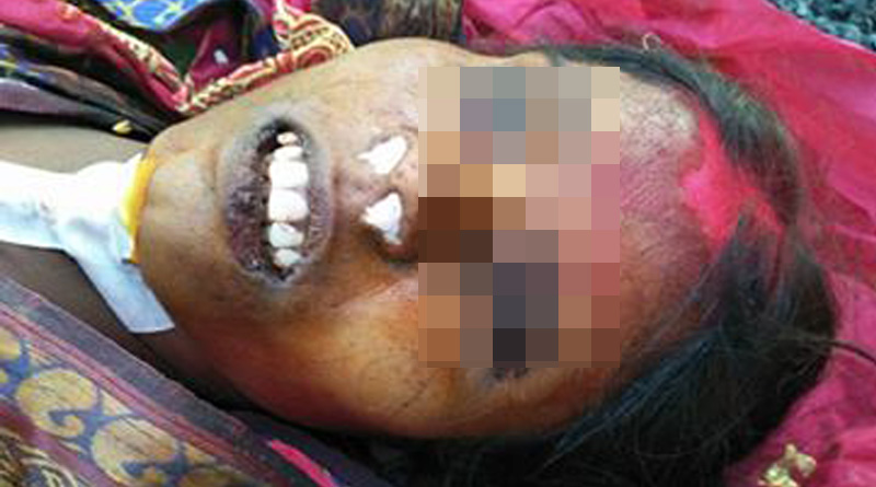 Right eye of a dead lady is bitten by Rat in the morque Of a government hospital