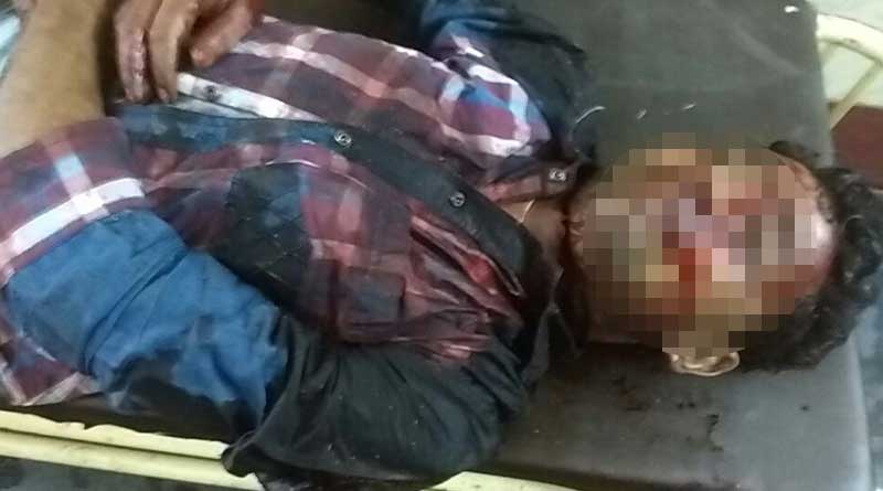 Auto driver hacked to death in Katwa