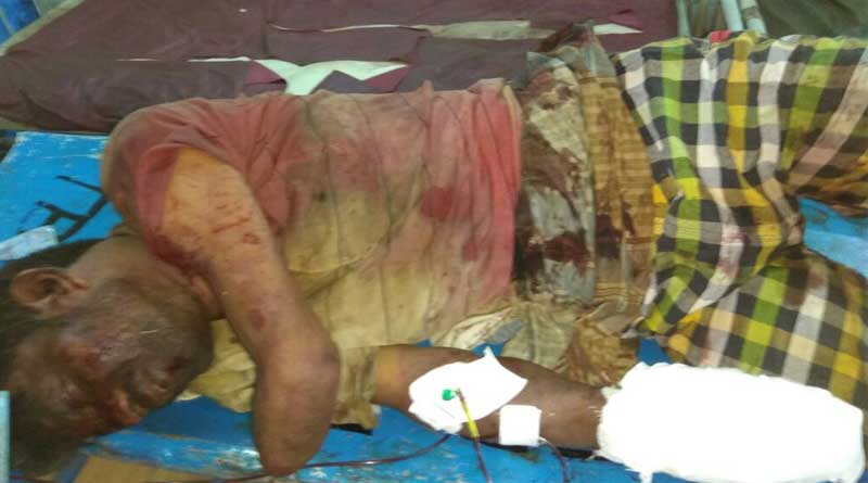 Blast near Dum Dum Cantonment, one injured
