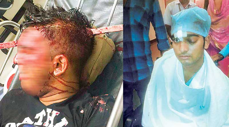 Man impaled in head saved by Kolkata doctors