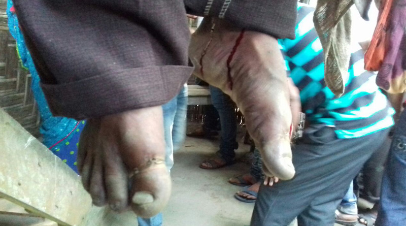 Manua horror rerun in Malbazar, wife stabs husband to death
