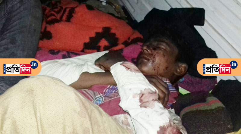 Relatives of Birbhum quarry blast victims clueless about future 