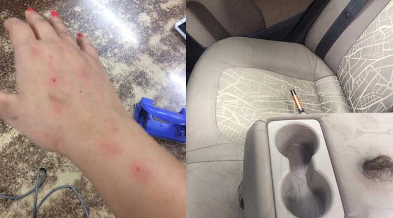 Mumbaii: A lady journalist brutally assualted in Uber cab 
