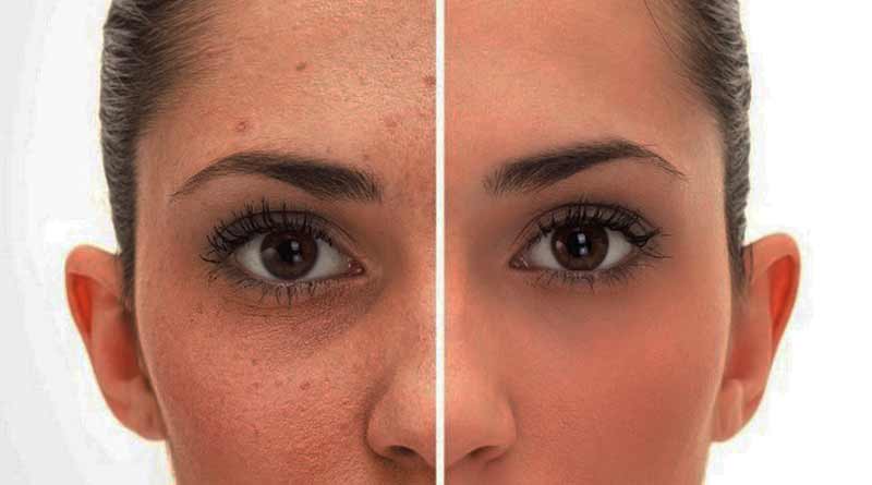 Face-Skin-Care