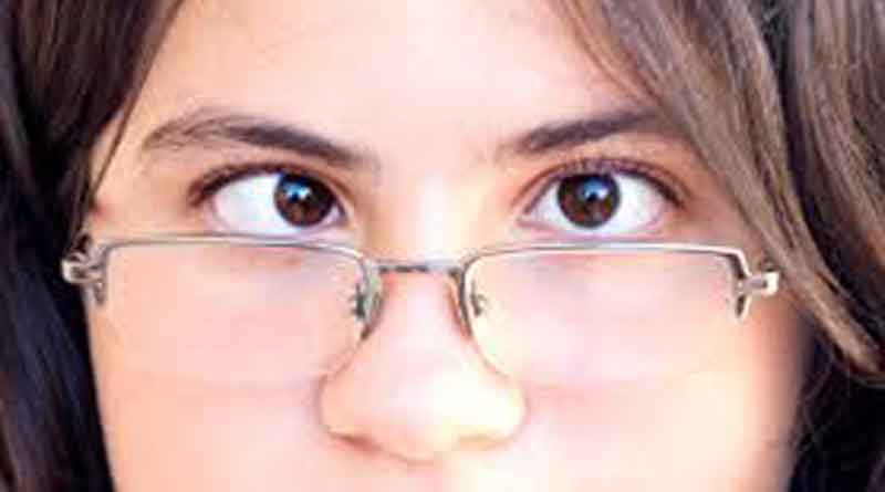 Cross eye can be corrected at tender age by treatment