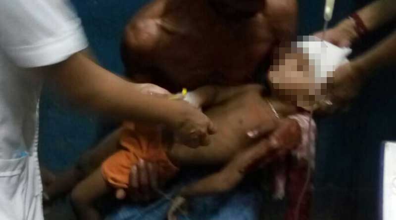 Political violence in Malda, child shot in the head