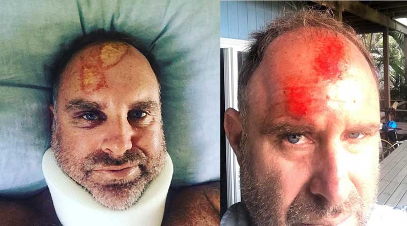 Australian cricketer Matthew Hayden critical after accident