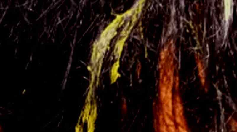 Eve teasers use chemical in Uttarpara