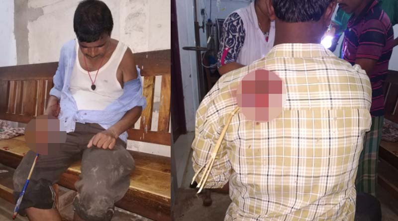 Two TMC supporters allegedly sticked by arrows in Keshipur