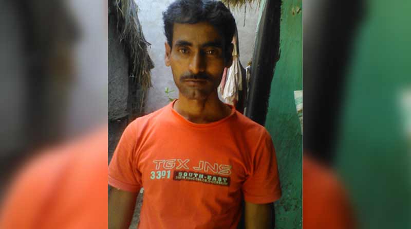 BJP worker allegedly beaten by some goons in Katwa