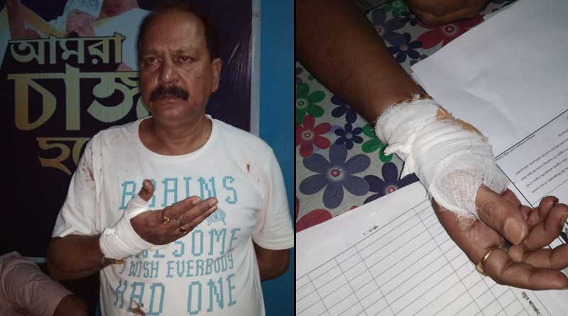 TMC Leader attacked by goon in Durgapur, accused beaten