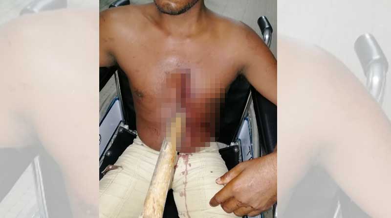 Doctors save life of a youth in Kolkata's RG Kar hopsital
