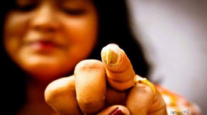 Sangbedan, an NGO organises exceptional move towards 'Bonfota'