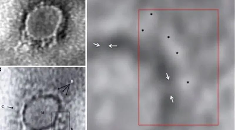 coronavirus