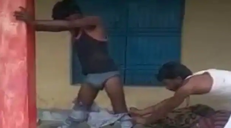 Cobra crawls into man's pants