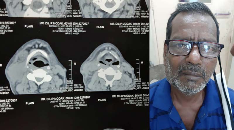 Rare and Rinky Surgery makes Man free from Cancer