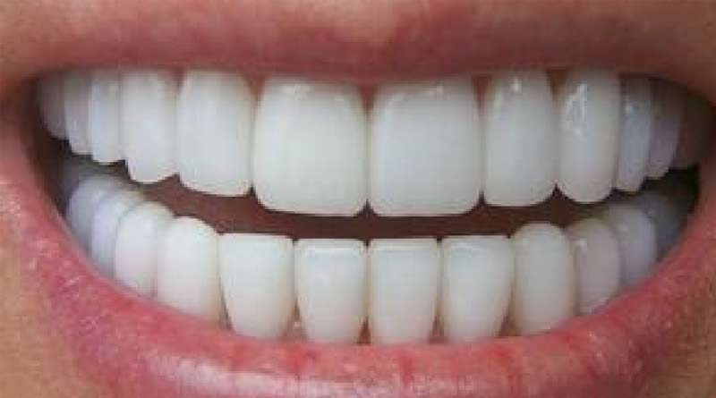 Teeth show that epidemics began much further back in history