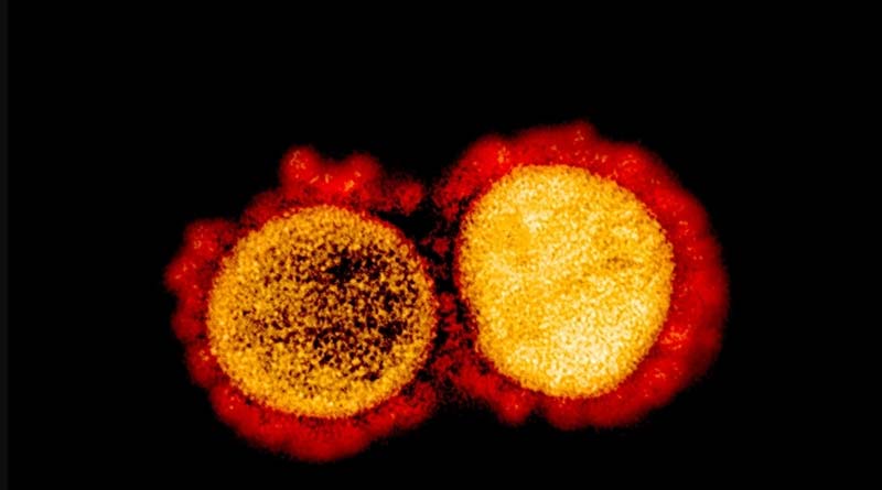 10 times more infectious! Malaysia detects new strain of COVID-19