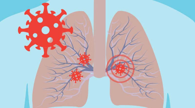Corona Virus may cause permanent damage to lungs, scientists say