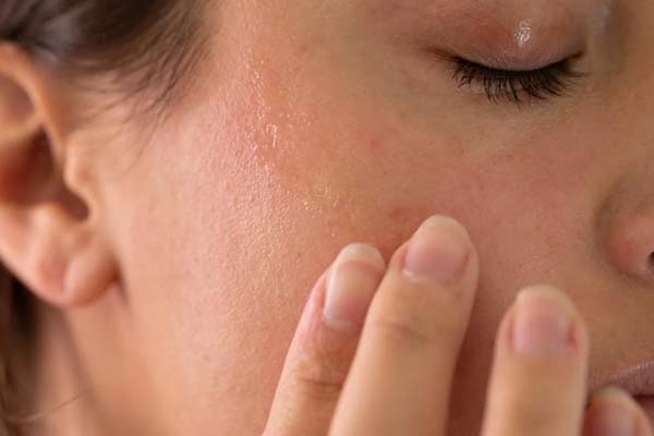 Dry skin