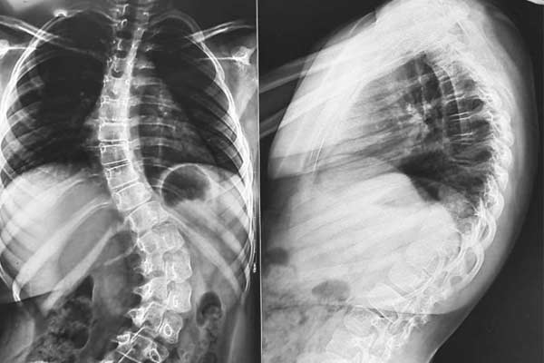 The Kolkata hospital cured the minor with rare surgery