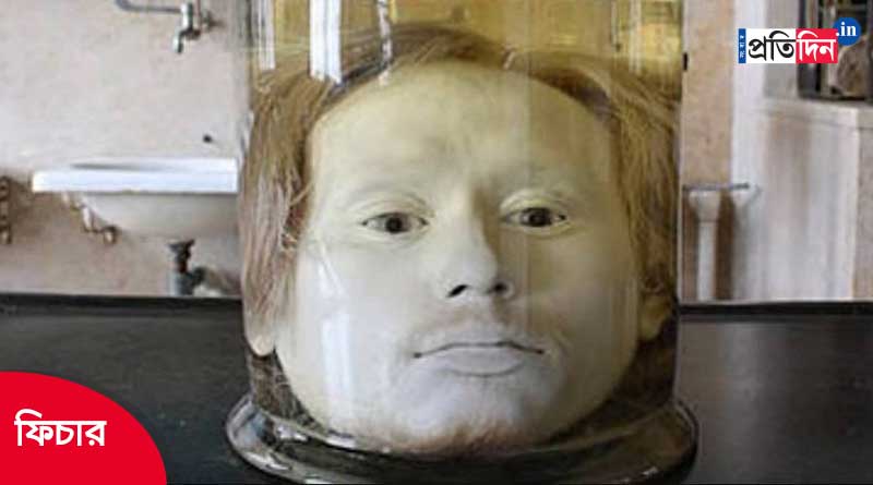 Story of a serial killer’s 179 year old head in a jar | Sangbad Pratidin