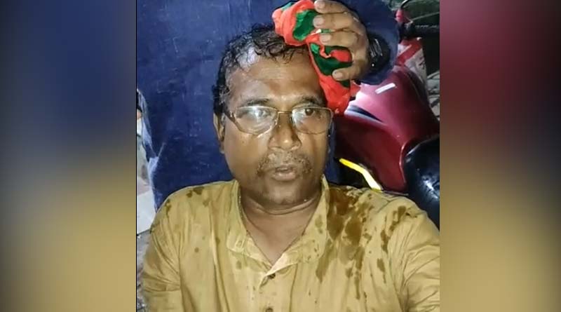 WB Assembly Poll: Tamluk BJP Candidate physicsaly assulted by TMC workers admitted in ICU | Sangbad Pratidin