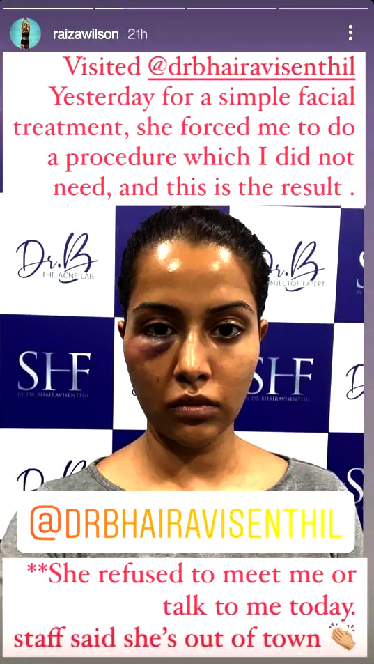 Tamil actress Raiza Wilson says she was ‘forced’ to undergo dermatological treatment, shares photo after it goes wrong