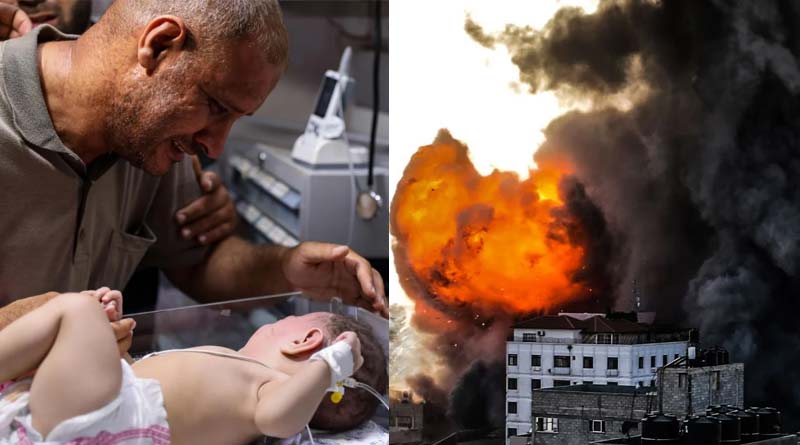 Bereaved Gaza father clutches wounded baby boy says have no one left in world| Sangbad Pratidin