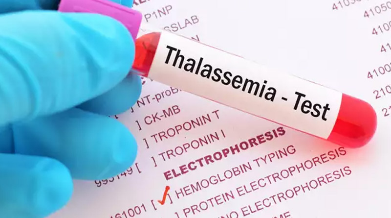 State Govt. Hospitals to get co-oximeter machine to detect thalassemia patient | Sangbad Pratidin
