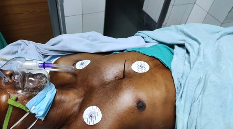 SSKM hospital gives arrow struck elderly man new life | Sangbad Pratidin