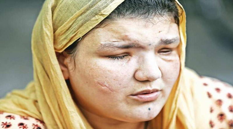 Former Afghan police woman recounts Taliban attack on her। Sangbad Pratidin
