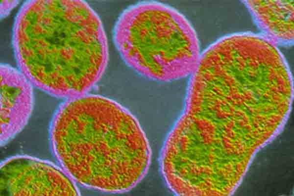 brucellosis