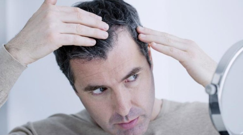 How to reduce white hair in young age | Sangbad Pratidin