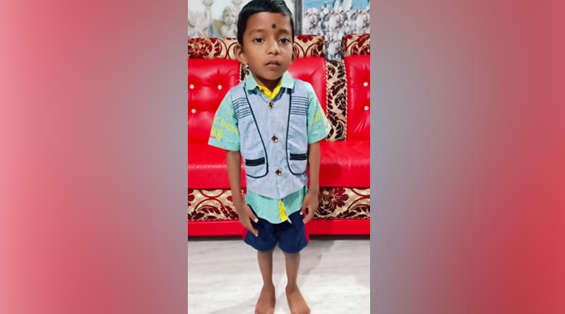 SSKM Hospital cures toddler suffering from cerebral palsy | Sangbad Pratidin