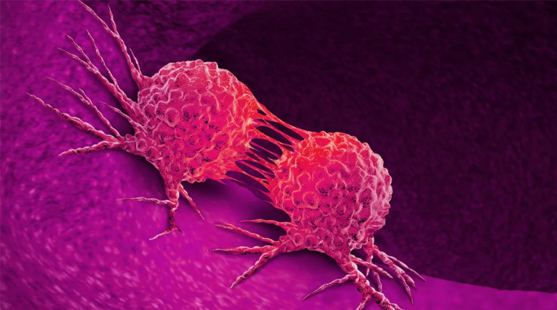 US journal publishes unique research work on cancer cure | Sangbad Pratidin