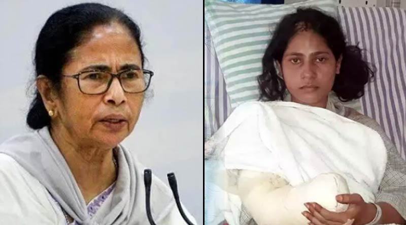 West Bengal government will bear cost of treatment for nurse attacked by husband | Sangbad Pratidin