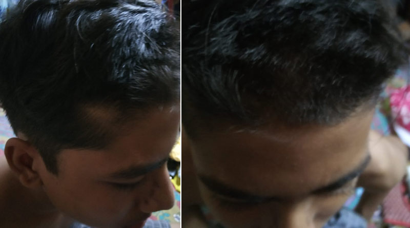 Headmistress accused of cutting hair of the students as 'punishment' in North 24 Parganas | Sangbad Pratidin