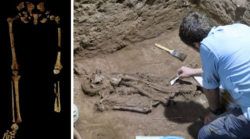 Researchers have unearthed the first evidence of the world's oldest amputation that dates back to 31,000 years ago। Sangbad Pratidin