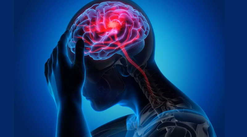 According to a new research, a person's blood type may be linked to their risk of having an early stroke। Sangbad Pratidin