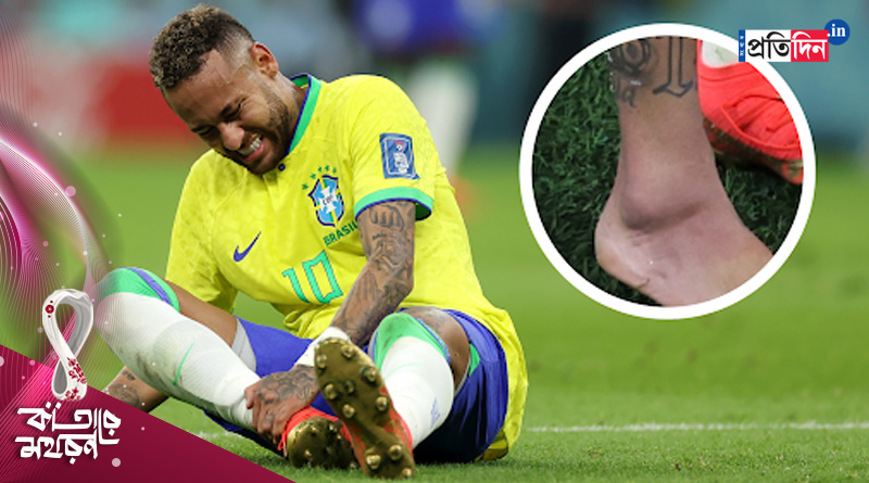 Neymar injured on Brazil vs Serbia match, might not play next game | Sangbad Pratidin
