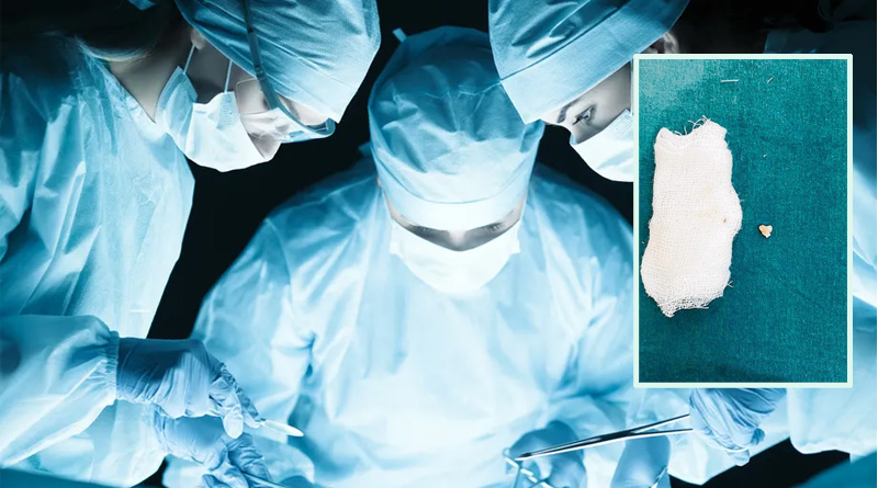 Rare telescopic Bronchoscopy Operation In Bardhaman Medical Collage and Hospital | Sangbad Pratidin