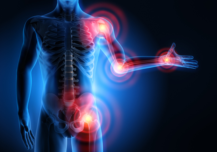 Joint Pain 1