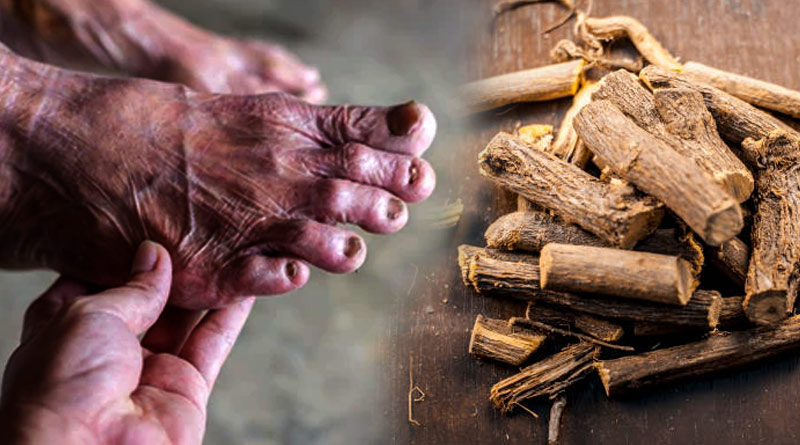 Roots implanted in old lady's leg to reduce pain | Sangbad Pratidin